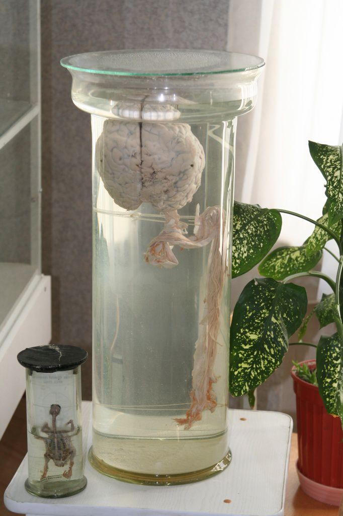 Экспозиция - Анатомия человека - 1